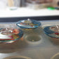 resin buttons